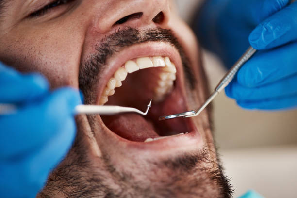 Best Emergency Dental Services for Seniors in St Marys, WV