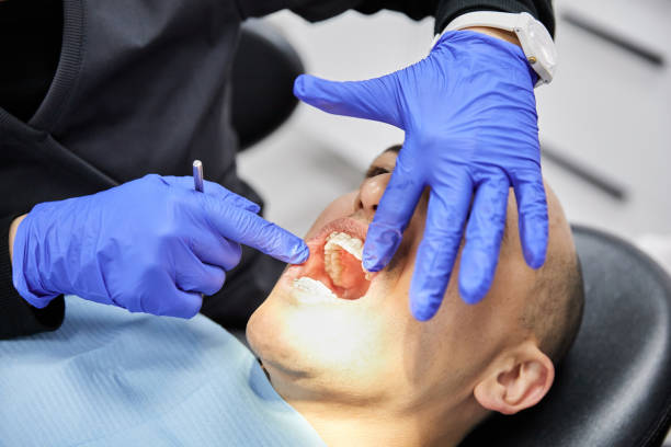 Best Emergency Dentist for Knocked-Out Tooth in St Marys, WV